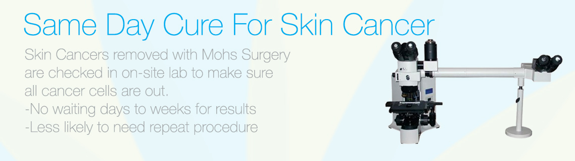 Mohs Surgery can offer a same day cure for skin cancer at Bravia Dermatology